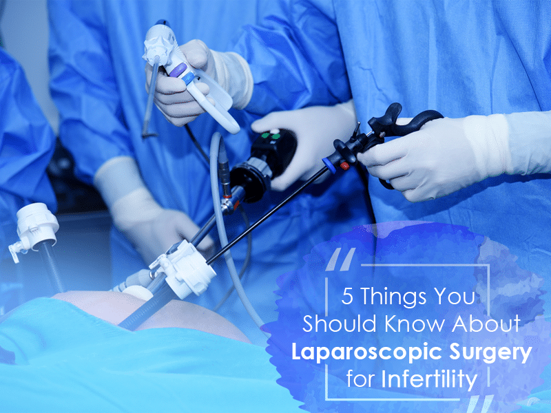 5 Things You Should Know About Laparoscopic Surgery For Infertility